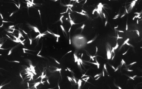 Analizan el comportamiento excepcional de espermatozoides que se agrupan para nadar más rápido Analizan el comportamiento excepcional de espermatozoides que se agrupan para nadar más rápido