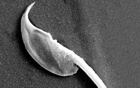 Investigadores del MNCN describen cómo la expresión de una proteína influye en la mejora del semen Investigadores del MNCN describen cómo la expresión de una proteína influye en la mejora del semen