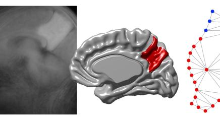 Cerebral Cortex 2025 / Bruner and Gallareto-Sande
