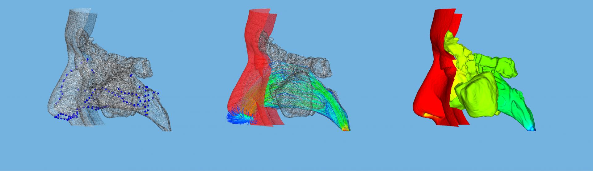 Modelos 3D de vías aéreas nasales