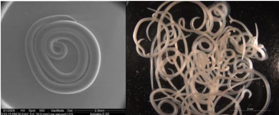 Anisakis  una bomba alergénica