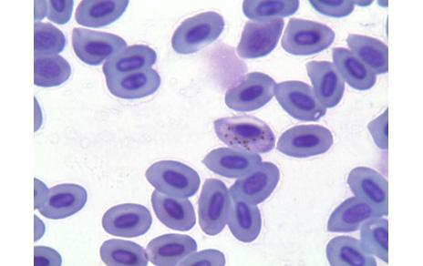 Malaria  mosquitos y aves silvestres