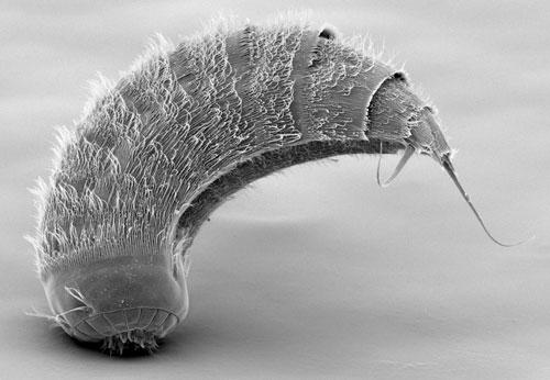 Imágen de microscopía electrónica de un Kinorrinco
