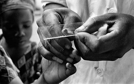 Toma de muestra de sangre.  ©OMS Pierre A.Pittet 1958