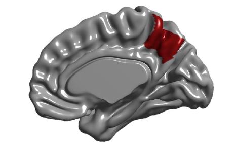 El precúneo se sitúa en la hendidura entre los dos hemisferios cerebrales. En la imagen resaltado en rojo sobre la cara interna de uno de los hemisferios. / E. Bruner.